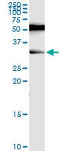 RAG2 Antibody in Western Blot (WB)