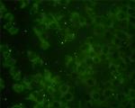 RAP2B Antibody in Immunocytochemistry (ICC/IF)