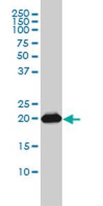 RAP2B Antibody in Western Blot (WB)