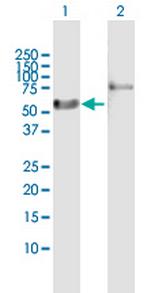 RARA Antibody in Western Blot (WB)