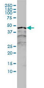 RARA Antibody in Western Blot (WB)