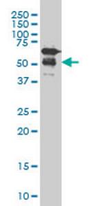 RARA Antibody in Western Blot (WB)