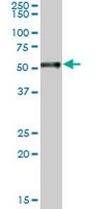 RARA Antibody in Western Blot (WB)