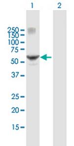 RARG Antibody in Western Blot (WB)