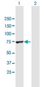 RARS Antibody in Western Blot (WB)