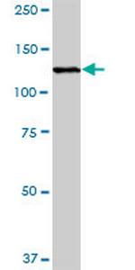 RASA1 Antibody in Western Blot (WB)