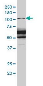 RASA1 Antibody in Western Blot (WB)