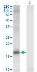 JARID1A Antibody in Western Blot (WB)