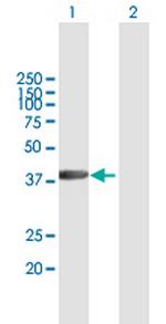 RBMY1A1 Antibody in Western Blot (WB)