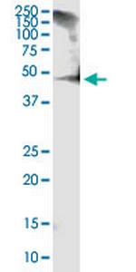 RCN1 Antibody in Western Blot (WB)