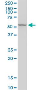 RCN2 Antibody in Western Blot (WB)