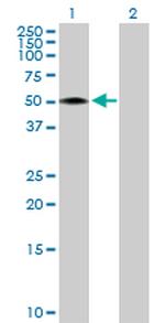 RCN2 Antibody in Western Blot (WB)