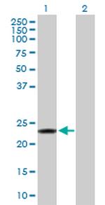 RCVRN Antibody in Western Blot (WB)