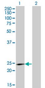 RCV1 Antibody in Western Blot (WB)