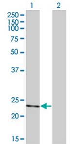 RCV1 Antibody in Western Blot (WB)