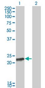 RCV1 Antibody in Western Blot (WB)