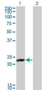 RCV1 Antibody in Western Blot (WB)