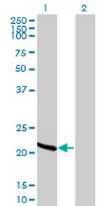 RCV1 Antibody in Western Blot (WB)