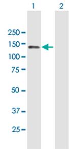 RET Antibody in Western Blot (WB)