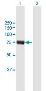 RFX4 Antibody in Western Blot (WB)