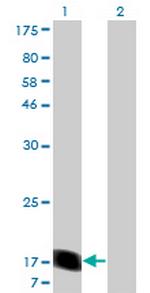 RHEB Antibody in Western Blot (WB)