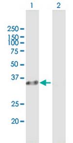 RLBP1 Antibody in Western Blot (WB)