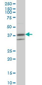 RNF2 Antibody in Western Blot (WB)