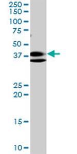 RNF2 Antibody in Western Blot (WB)