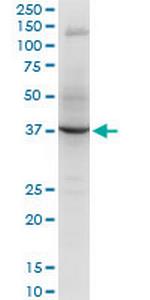 RNF2 Antibody in Western Blot (WB)