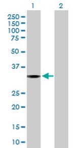 ROM1 Antibody in Western Blot (WB)