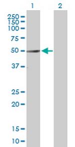 RORA Antibody in Western Blot (WB)