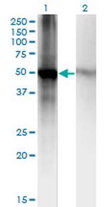 RORB Antibody in Western Blot (WB)