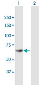 RPA1 Antibody in Western Blot (WB)