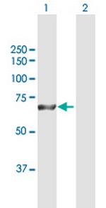 RPA1 Antibody in Western Blot (WB)