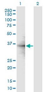 RPL6 Antibody in Western Blot (WB)