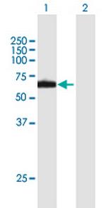 RPN2 Antibody in Western Blot (WB)