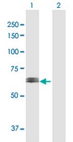 RPN2 Antibody in Western Blot (WB)