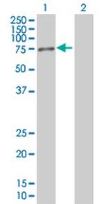 RPS6KA3 Antibody in Western Blot (WB)