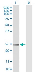 RRAS Antibody in Western Blot (WB)