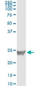 RRAS Antibody in Immunoprecipitation (IP)