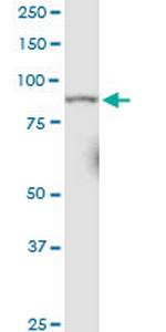 RRM1 Antibody in Western Blot (WB)