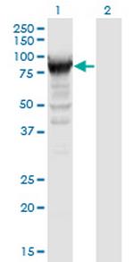 RRM1 Antibody in Western Blot (WB)