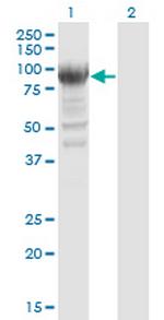 RRM1 Antibody in Western Blot (WB)