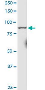 RRM1 Antibody in Western Blot (WB)