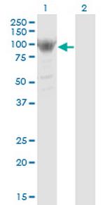 RRM1 Antibody in Western Blot (WB)