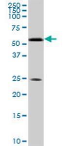 RXRA Antibody in Western Blot (WB)