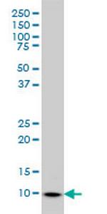 S100A6 Antibody in Western Blot (WB)