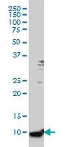 S100A6 Antibody in Western Blot (WB)