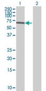 SARS Antibody in Western Blot (WB)