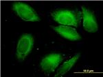 SARS Antibody in Immunocytochemistry (ICC/IF)